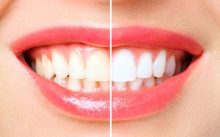5 natural herbs that help whiten teeth