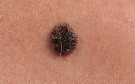 Men above 40 must watch out for these types of cancer