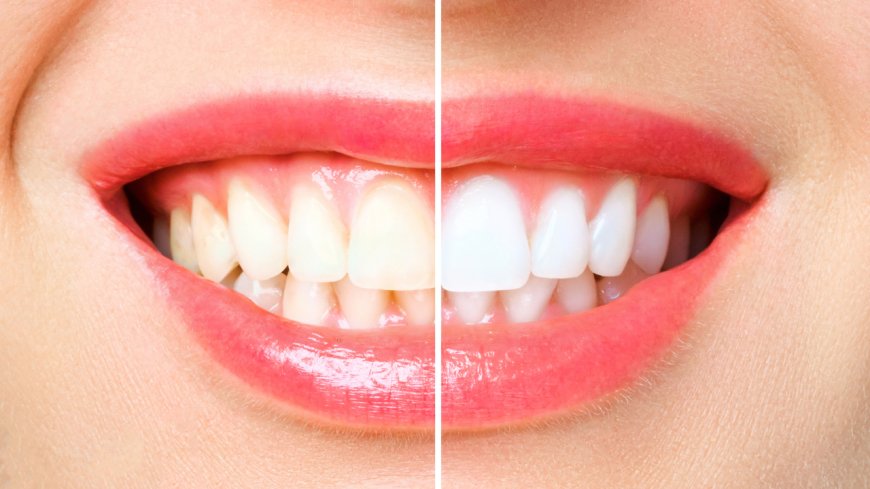 5 natural herbs that help whiten teeth