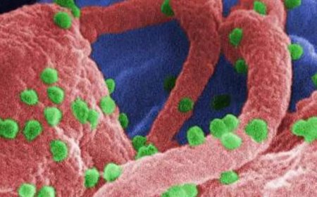 Gilead's tie up with generic cos may not address HIV challenge