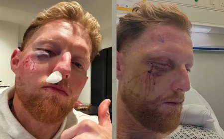 Ben Stokes undergoes facial surgery after freak blow, shares pic